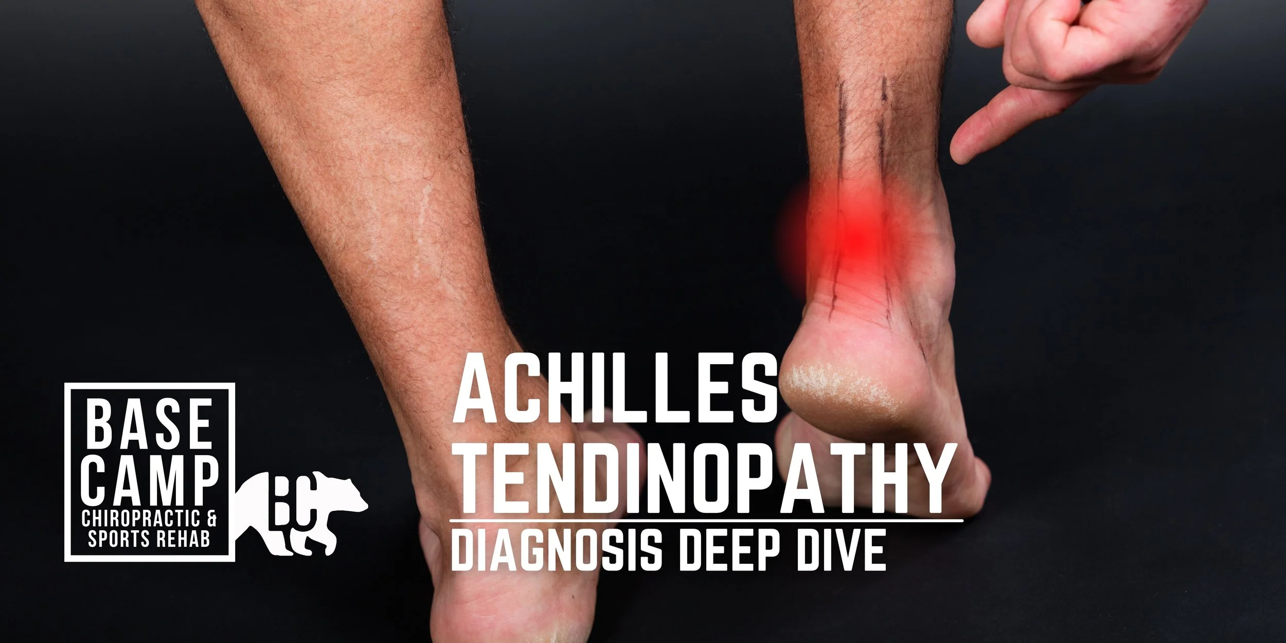 Pain at base of 2025 achilles tendon